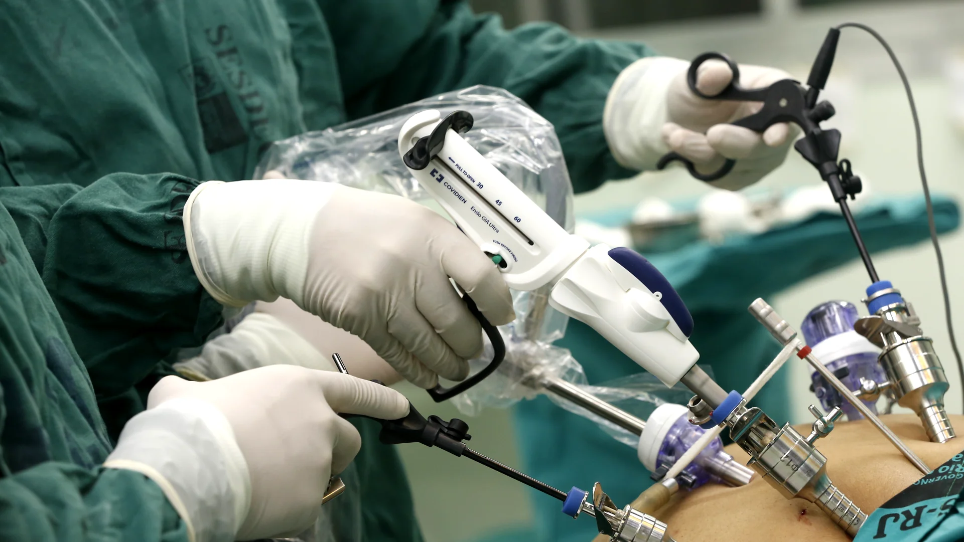 Endoscopy vs Laparoscopy Instruments: Key Differences, Uses & Advantages - Engineering & Manufacturing Blog